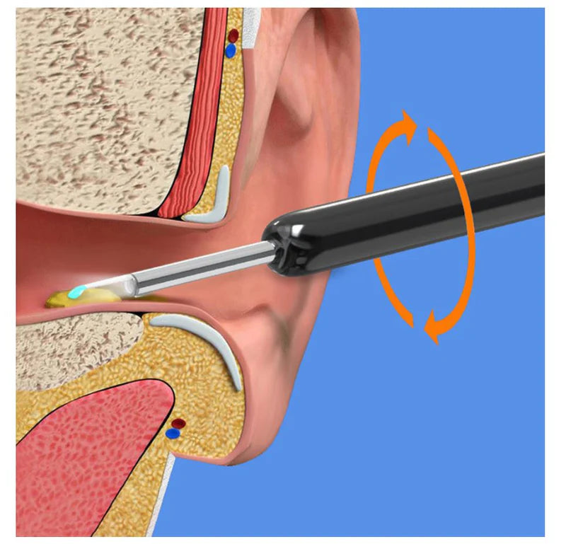 Smart Ear Wax Cleaner with HD Camera